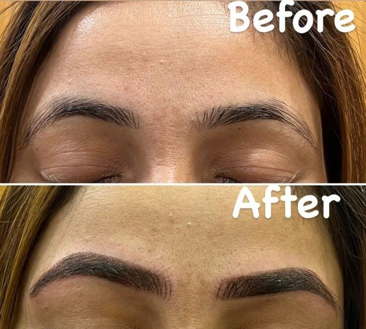 Before and after treatment comparison